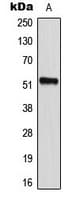 Polyclonal Rabbit anti-Human CD2BP2 Antibody (Internal, IHC, WB)