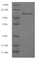 Human CXCR4 Protein (Recombinant 6His-SUMO, N-terminus)