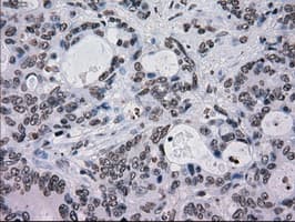 TYRO3 Antibody (clone OTI5B4)
