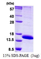 Human LAIR2 / CD306 Protein (Recombinant His)