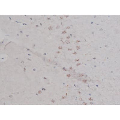 NPM1 / NPM / Nucleophosmin Antibody (phospho-Thr199)