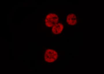 HNRNPD / AUF1 Antibody (phospho-Ser83)