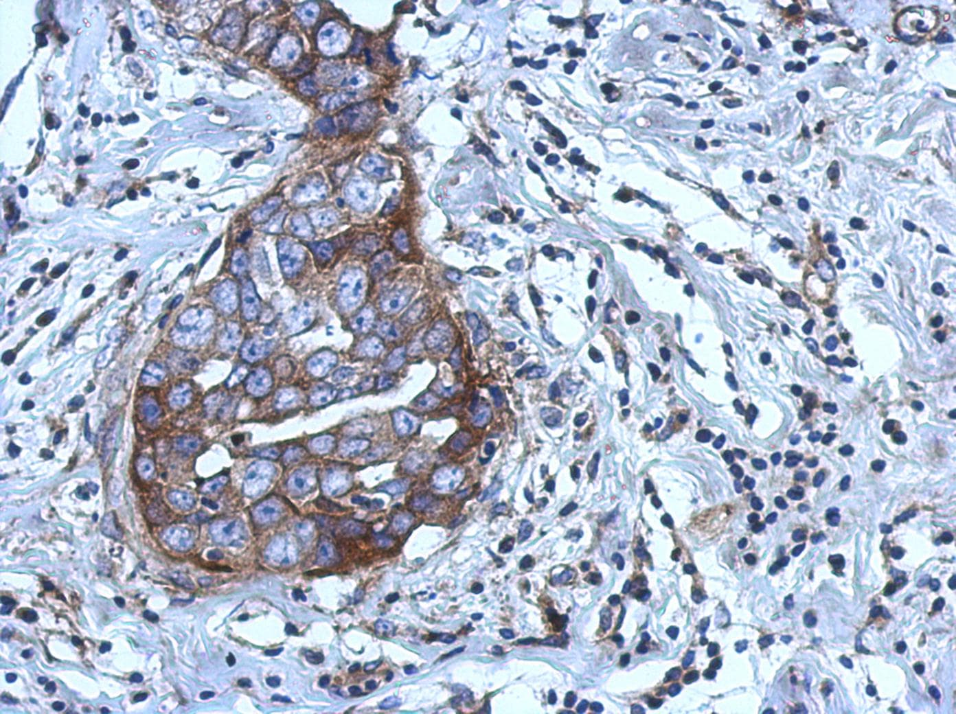 RGS4 Antibody (aa1-205)