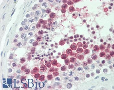 HMMR / CD168 / RHAMM Antibody (aa577-724)