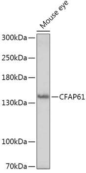 CFAP61 / C20orf26 Antibody