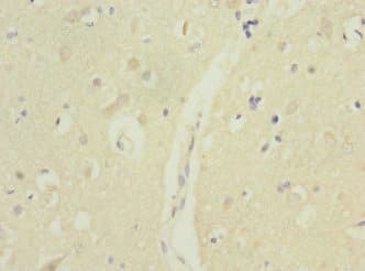 MTERF3 / MTERFD1 Antibody