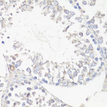 MAP1LC3B / LC3B Antibody