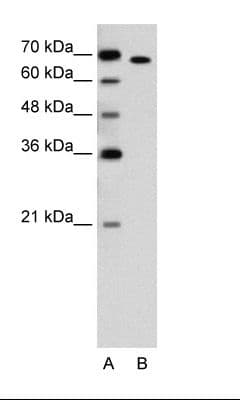 RORA / ROR Alpha Antibody (aa239-288)