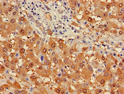 PGM1 / Phosphoglucomutase 1 Antibody (aa1-562)