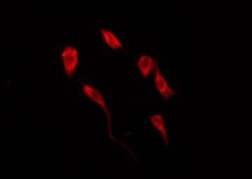 IRS1 Antibody (phospho-Ser639)