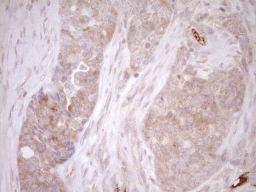 MLPH / Melanophilin Antibody (aa295-600, clone OTI6E8)