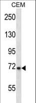 IHC-plus™ Polyclonal Rabbit anti-Human KCND3 / Kv4.3 Antibody (aa13-41, IHC, WB)