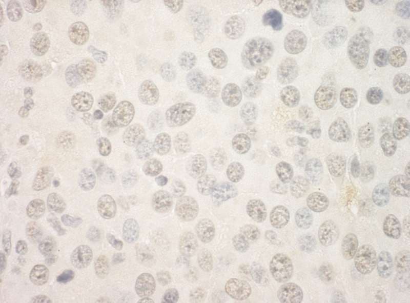 Polyclonal Rabbit anti-Human FOXP1 Antibody (aa627-677, IHC)