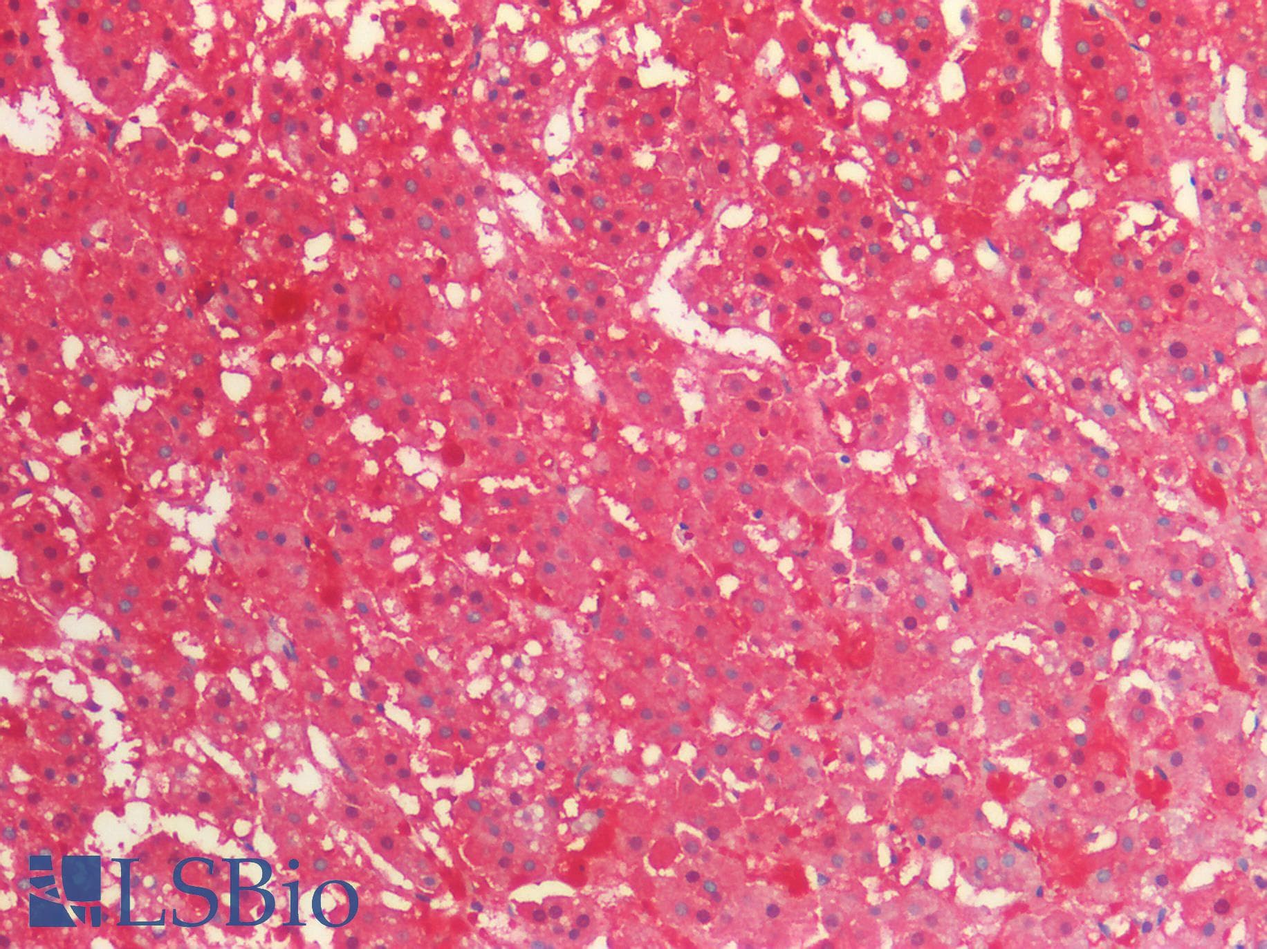 PathPlus™ IDH1 / IDH Antibody (clone C13)