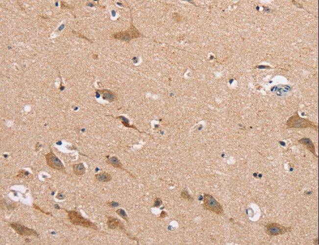 Polyclonal Rabbit anti-Human MSMB / MSP Antibody (IHC, WB)