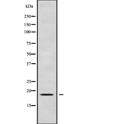 RPL24 / Ribosomal Protein L24 Antibody (aa90-120)