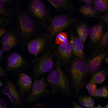NFKB1 / NF-Kappa-B Antibody (phospho-Ser337)