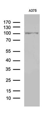 Monoclonal Mouse anti-Human ALS2CR11 Antibody (clone OTI7A8, aa307-623, WB)