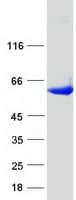 Human UGP2 Protein (Recombinant Myc-DDK (Flag))