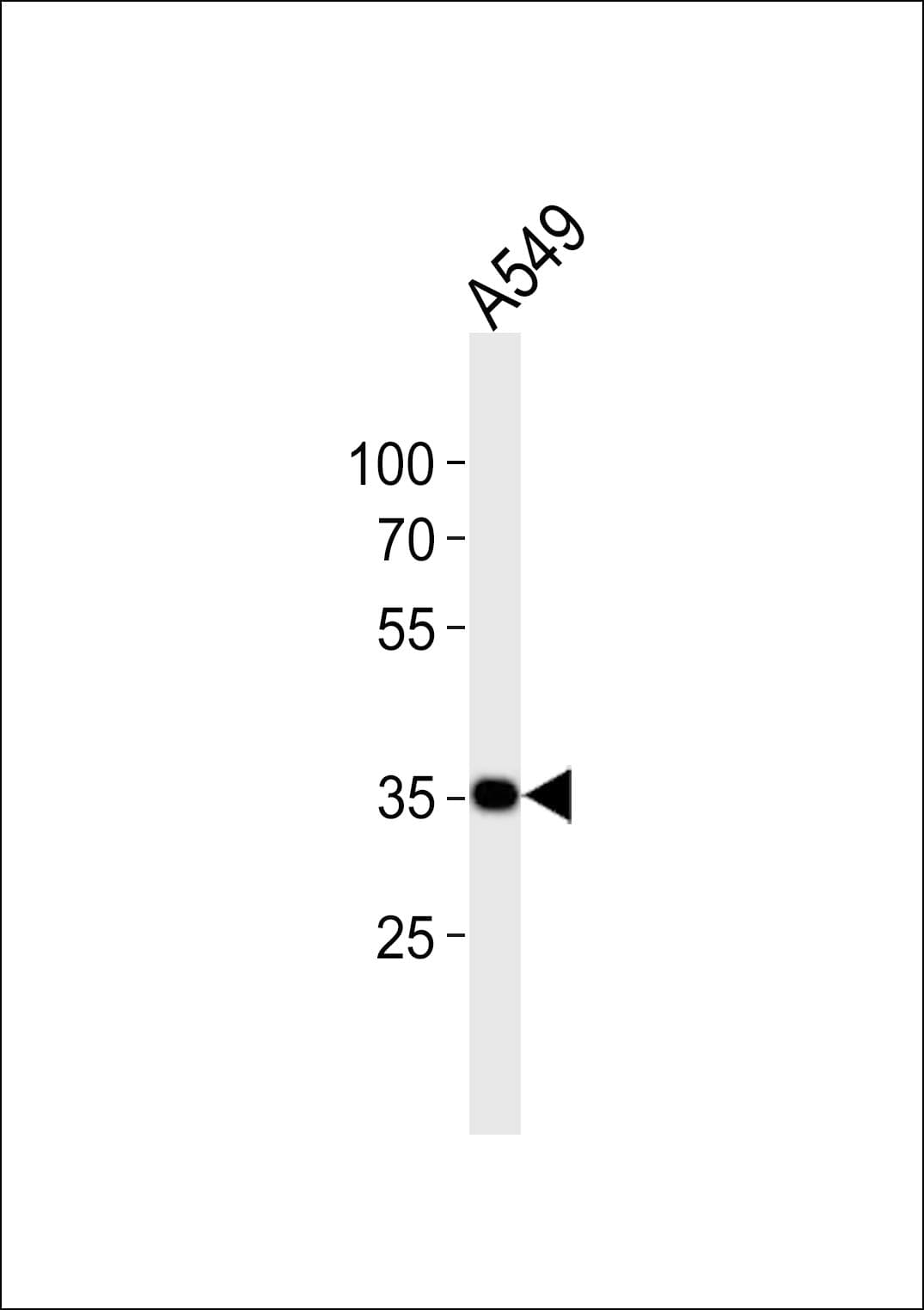 LAPTM4B Antibody (aa80-114)