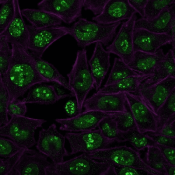 MKI67 / Ki67 Antibody (clone MKI67/2466)