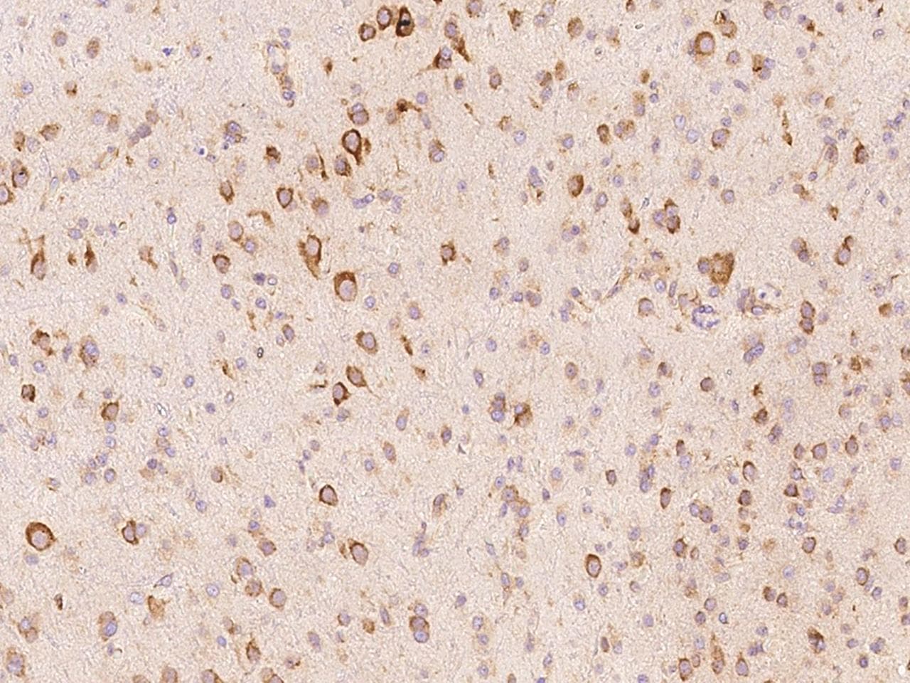 ALK-6 / BMPR1B Antibody (Preservative Free)