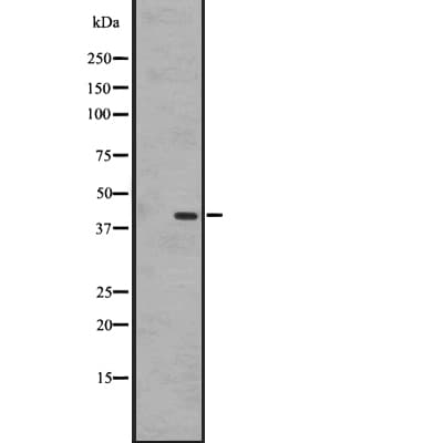 GPR183 / EBI2 Antibody