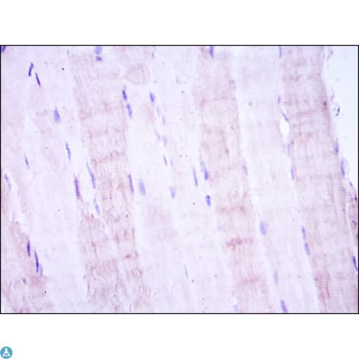 MAP2K4 / MKK4 Antibody