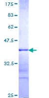 Human MYST3 / MOZ Protein (Recombinant GST, N-terminus)