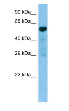 Polyclonal Rabbit anti-Human TACR3 / NK3R Antibody (C-Terminus, WB)