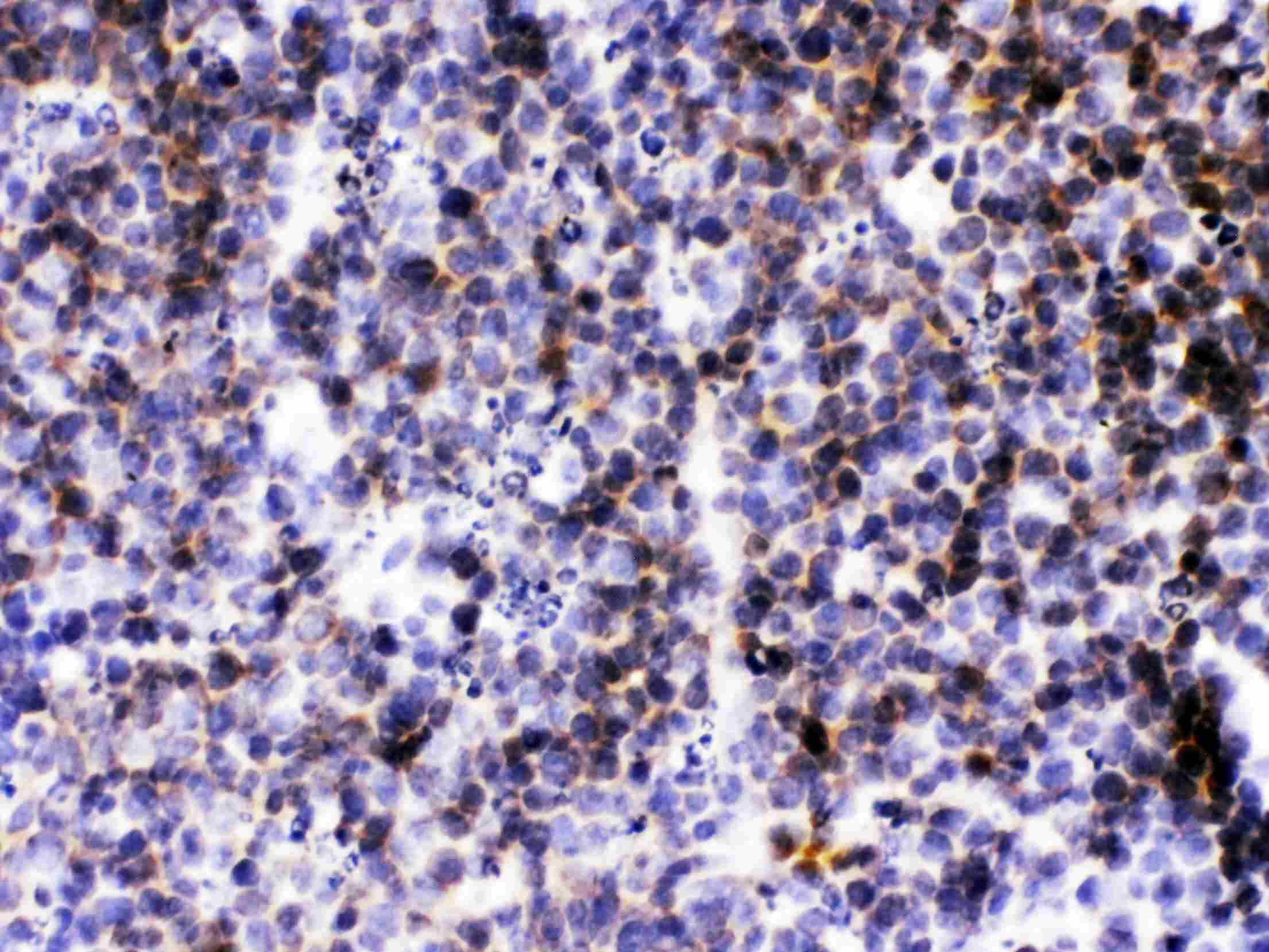 BLC / CXCL13 Antibody
