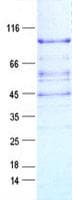 Human APLF / PALF Protein (Recombinant DDK,C-terminus)