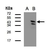 CAMK1D Antibody (aa1-205)
