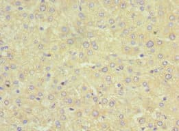SRI / Sorcin Antibody (aa1-198)