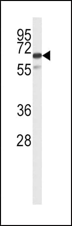 IHC-plus™ SLC22A6 / OAT1 Antibody (aa513-541)