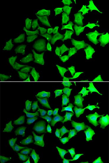 Polyclonal Rabbit anti-Human TALDO1 / Transaldolase 1 Antibody (IHC, IF, WB)