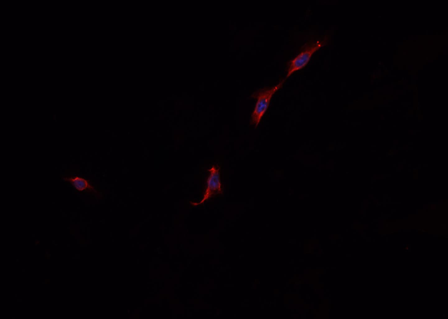 SQSTM1 Antibody