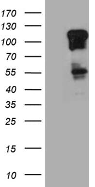 ZBTB17 / MIZ-1 Antibody (aa112-457, clone OTI2G1, Carrier-free)