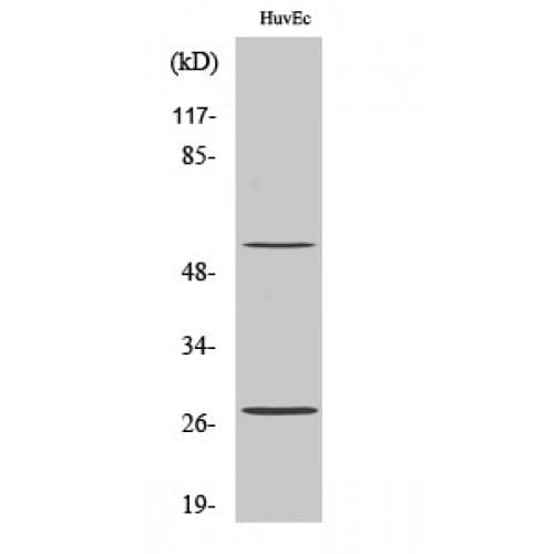 CD69 Antibody (70-150 aa, Internal)