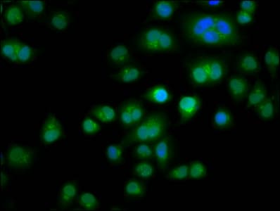 TES / Testin Antibody (aa130-260)