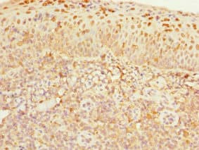 CDC7 Antibody