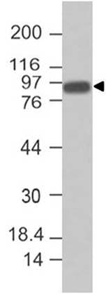 VIL1 / Villin Antibody