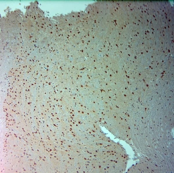 ARX Antibody (aa2-50)