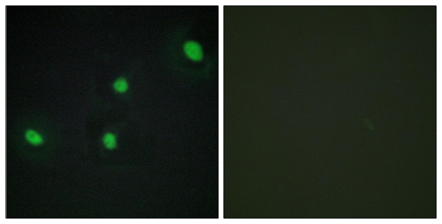 CDCA4 Antibody