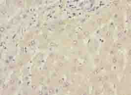 Polyclonal Rabbit anti-Human WDR74 Antibody (IHC, WB)