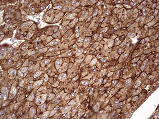 APOE / Apolipoprotein E Antibody (clone OTI1H6)