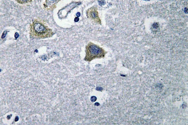 CA-VB / CA5B Antibody (Asn280)