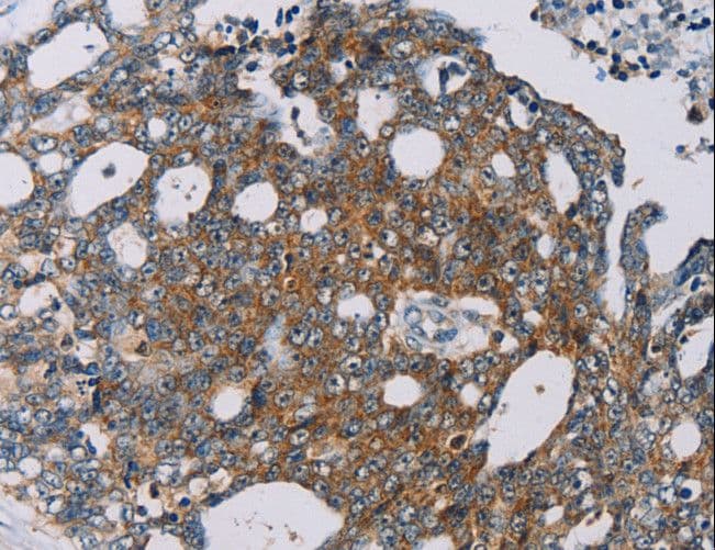 MRPL39 Antibody