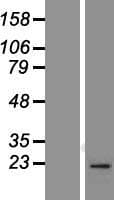 RAB1B Protein (Over-Expression Lysate Myc-DDK (Flag))