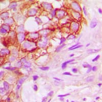 Polyclonal Rabbit anti-Human KSR1 Antibody (Internal, IHC, IF, WB)